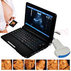 190891409850 Carejoy Laptop Ultrasound Scanner Diagnostic Convex Probe In 190891409850 Carejoy Laptop Ultrasound Scanner Diagnostic Convex Probe In