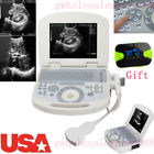 190891422491 Carejoy Us Ultrasound Scanner Machine System Convex Probe