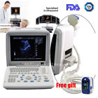 668817420170228055 Carejoy Portable Digital Ultrasound Scanner Machine Obstetric Convex 190891895400
