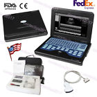 3.5convex Cms600p2 7.5linear Contec Ce Digital Portable Ultrasound Scanner Ultrasonic Machine Probes