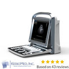 Eco1-vet Chison Veterinary Ultrasound Scanner With One Probe At Choice