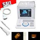 Rus-6000d Carejoy Full Digital Ultrasound Scanner Machie Convex Linear 190891234827 Rus-6000d Carejoy Full Digital Ultrasound Scanner Machie Convex Linear 190891234827