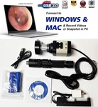 Rigid Endoscope Laparoscope Hd Usb Camera Head+coupler+light Source For R. Wolf. Fixed Price $375.00.